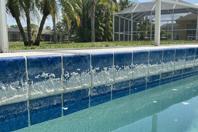 The Truth About Calcium Buildup: Why It Happens & How to Prevent It The Truth About Calcium Buildup: Why It Happens & How to Prevent It